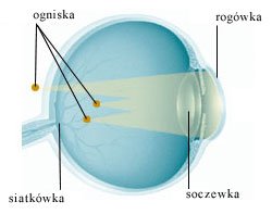 astygmatyzm gałka oczna